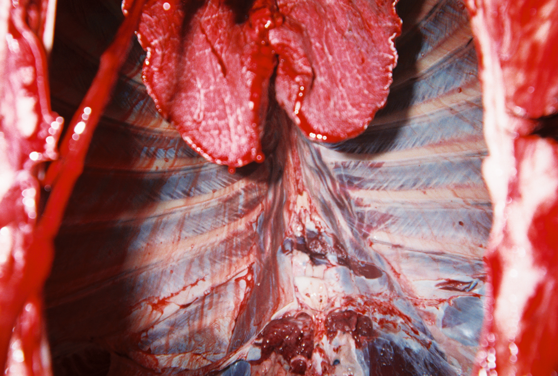 lungs.jpg